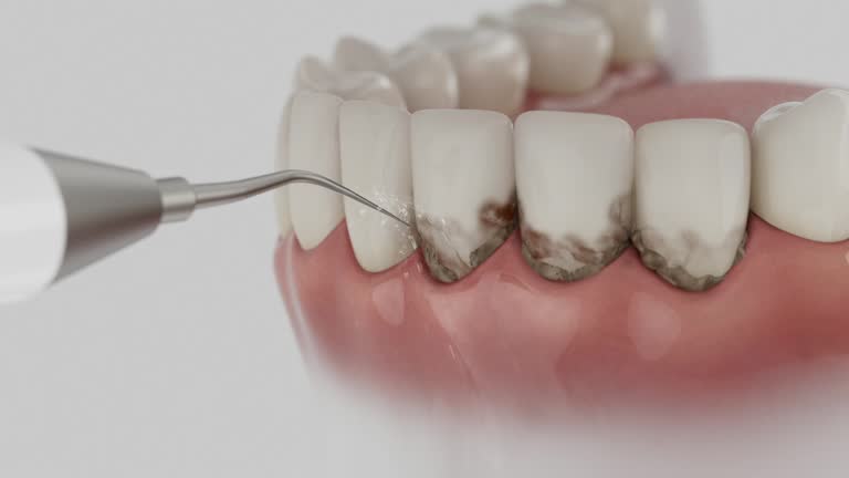 Reliable Dental Implants contractor in Omro, WI by Smile Center Dentistry